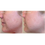 Murad AHA/BHA/Retinoid Daily Clarifying Peel