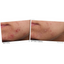 Murad Outsmart Blemish Clearing Treatment