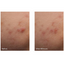 Murad Rapid Relief Spot Treatment