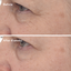 Murad Retinal ReSculpt Eye Lift Treatment