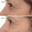 Murad Retinal ReSculpt Eye Lift Treatment