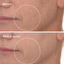 Murad Retinal ReSculpt Overnight Treatment