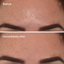 Murad Targeted Pore Corrector