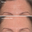 Murad Targeted Wrinkle Corrector