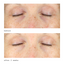Murad Vita-C Eyes Dark Circle Corrector