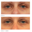 Murad Vita-C Eyes Dark Circle Corrector